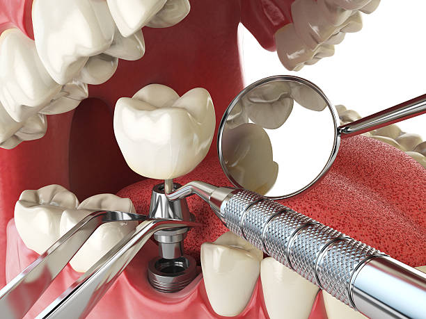 Best Broken or Cracked Tooth Emergency Dentist in Walters, OK